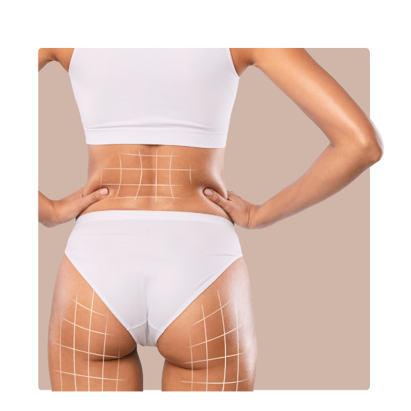 estetica corporal
